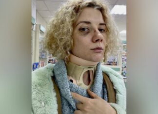 Актриса «Стиляг» Инна Коляда назвала имя жестоко избившего её